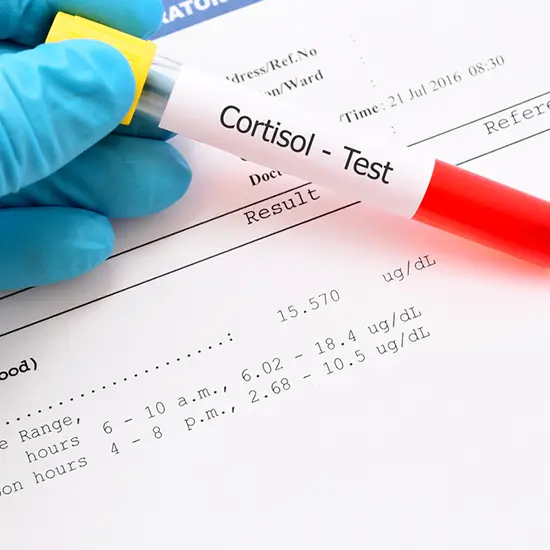 cortisol serum (morning sample)